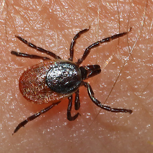 Ixodes ricinus